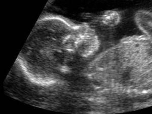 Тридцать недель беременности: развитие, положение, предлежание плода, ощущения мамы Движения малыша на 30 неделе